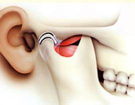 Disfunção da articulação temporomandibular (ATM).